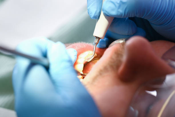 Best Cosmetic Emergency Dentistry in Bronte, TX
