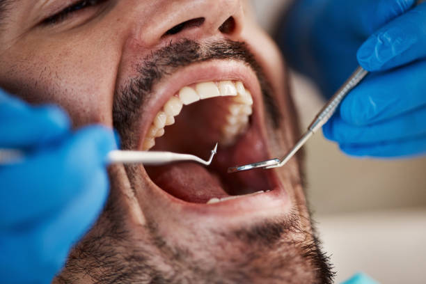 Best Emergency TMJ Treatment in Bronte, TX