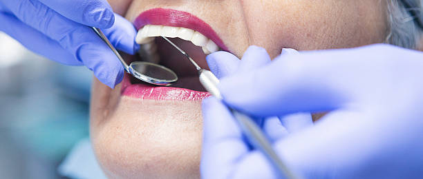 Best Emergency Tooth Extraction in Bronte, TX